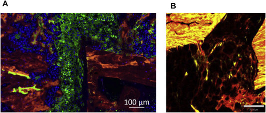 Delayed Fracture Healing in Obesity-associated Type 2 Diabetic Mouse Model