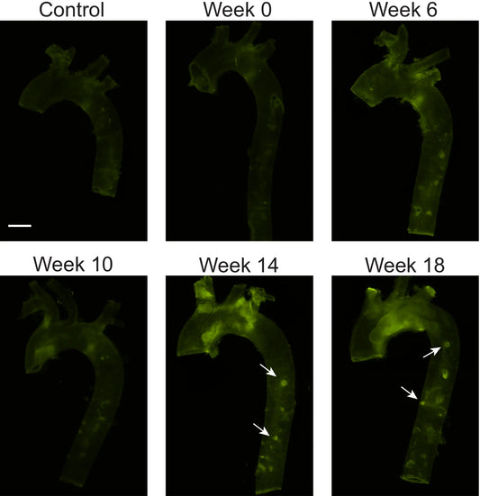 Detecting Early Arterial Damage in Atherosclerosis: How Collagen Hybridizing Peptides Overcome Diagnostic Challenges