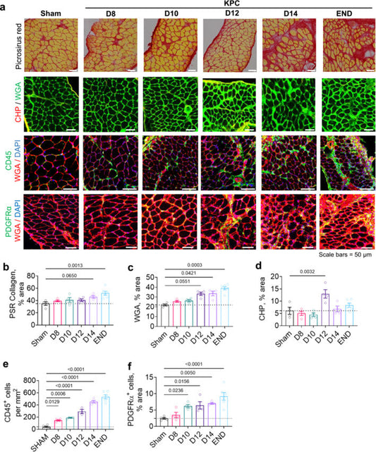 Pinpointing Fibrosis: How Collagen Hybridizing Peptides Illustrate Muscle Wasting in Pancreatic Cancer