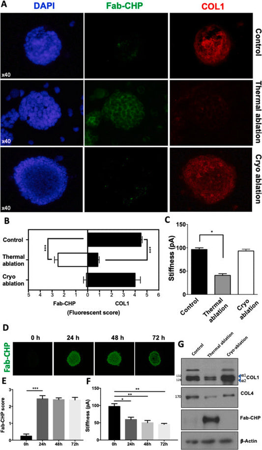 Collagen Hybridizing Peptides (CHPs): Unraveling the role of Denatured Collagen in Neuroblastoma.