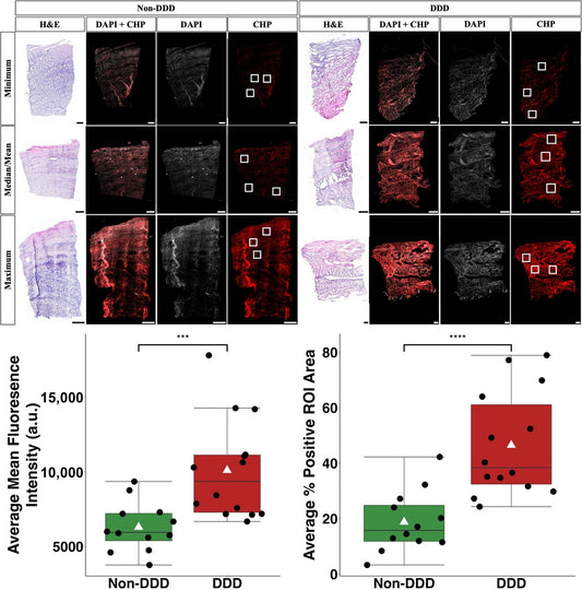 How Collagen Hybridizing Peptides Reveal Hidden Molecular Damage Behind Back Pain