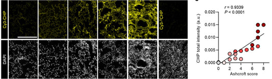 Using Collagen Hybridizing Peptides to Improve IPF Diagnosis and Imaging