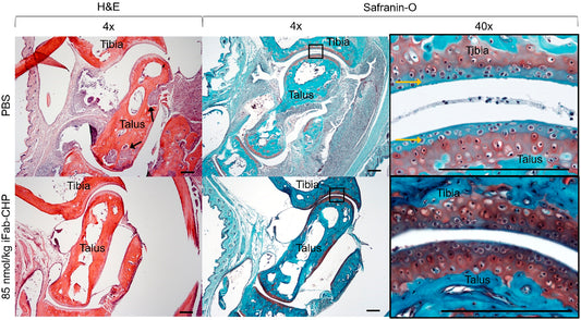Targeted Drug Delivery in Rheumatoid Arthritis: Leveraging Collagen Hybridizing Peptides for Enhanced Therapeutic Efficacy