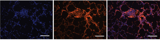 Histological detection of degraded collagens