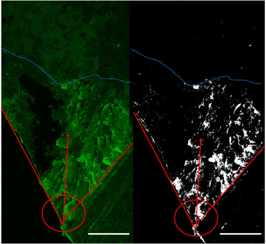First Empirical Evidence of Collagen Damage during Bone Fracture