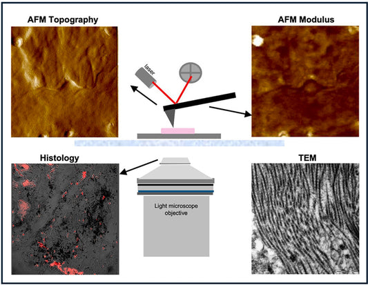 CHPs Contribute to Abdominal Aortic Anurrysm (AAA) Research)
