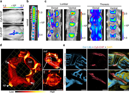 NIRF imaging and light sheet fluorescence microscopy of CHP targets in human spines