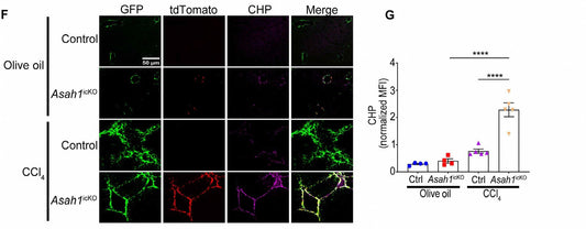 Resolving fibrosis by stimulating HSC-dependent extracellular matrix degradation