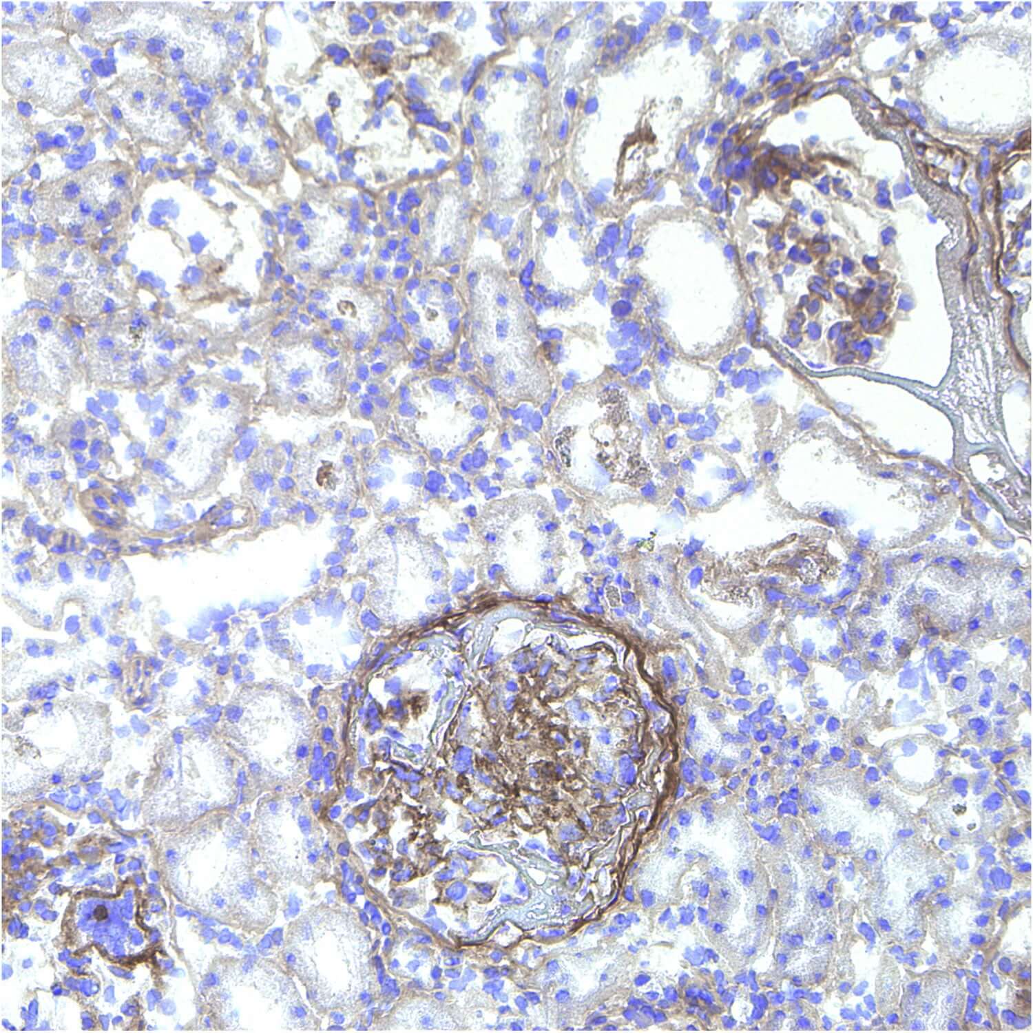 Collagen Hybridizing Peptide Stain: B-CHP Histology Stain