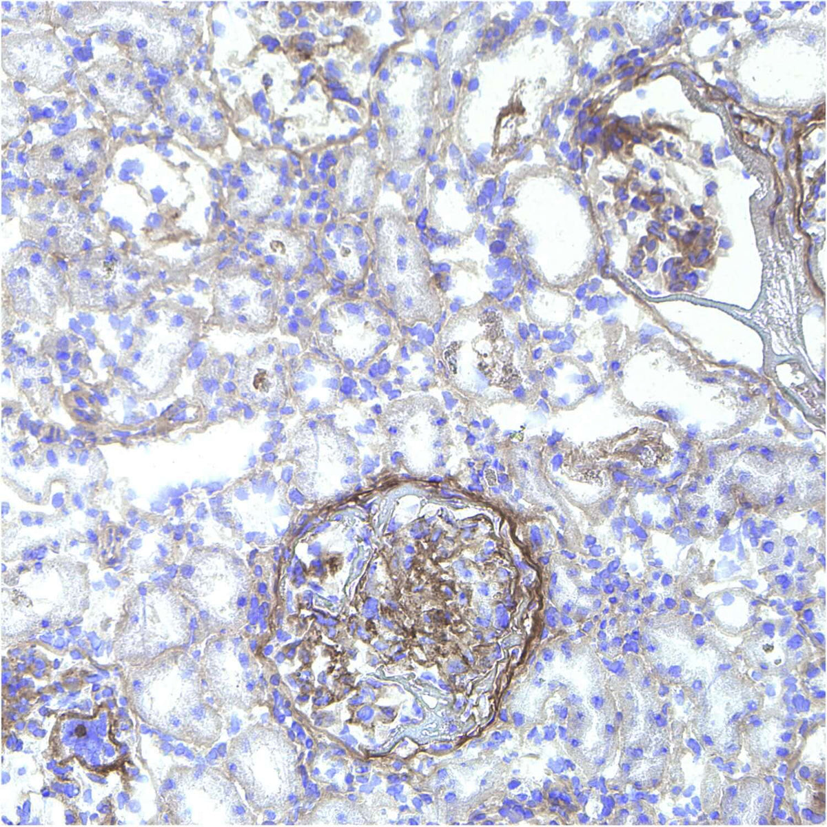 Collagen Hybridizing Peptide Stain: B-CHP Histology Stain