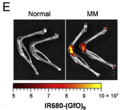 Collagen Hybridizing Peptide Multiple Myeloma In Vivo Staining